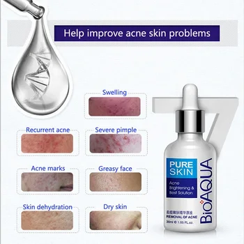 BIOAQUA Anti-Acne Treatment Face Cream Facial Serum Cleanser Mask Oil Control Shrink Pores Moisturizing Skin Whitening Care Set