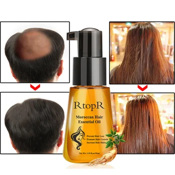 Marokańska wzrost włosów olejek przeciw wypadaniu włosów produkt 35 ml uszkodzenia sucha pielęgnacja włosów pielęgnacja olejek serum szybki wzrost włosów